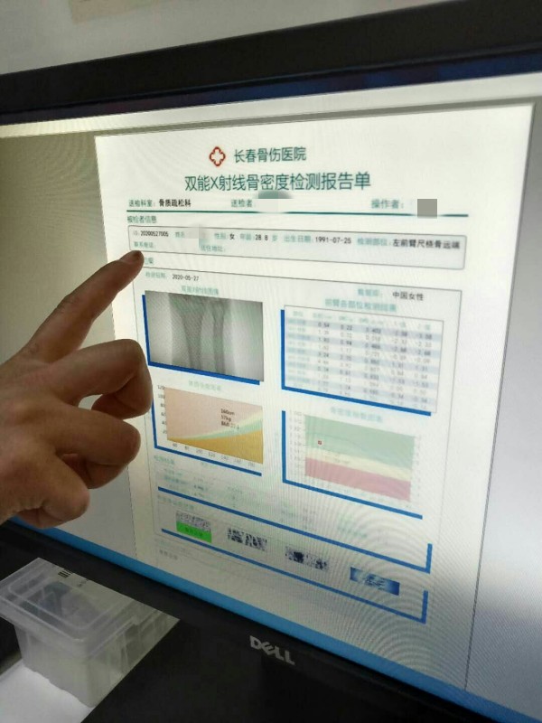 品源雙能X射線骨密度儀落戶吉林省長春骨傷醫(yī)院，助力骨松診療