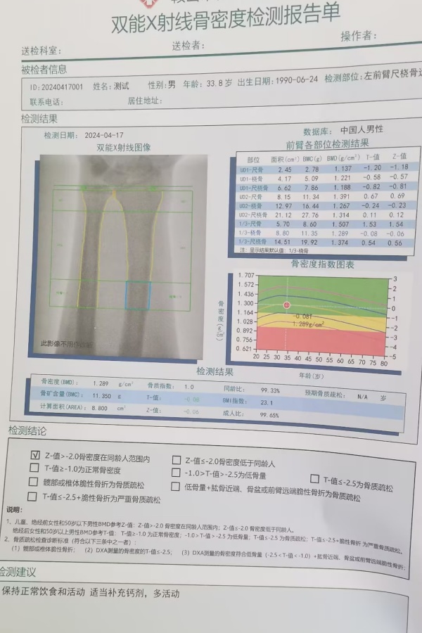 雙能X射線骨密度儀：準(zhǔn)確測量骨密度，助力骨質(zhì)疏松防治，守護骨骼健康